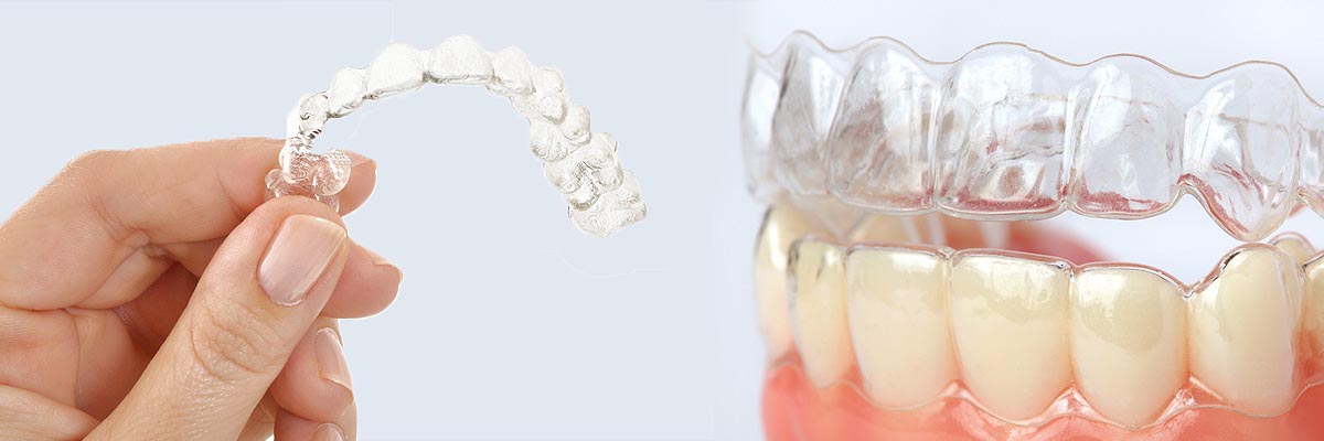 Long Grove Alternative to Braces for Teens