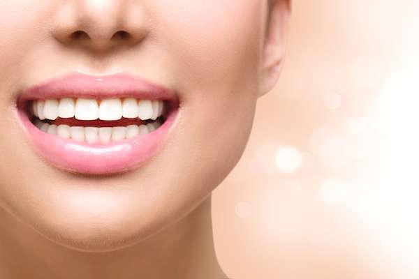 Dental Bonding vs. Contouring