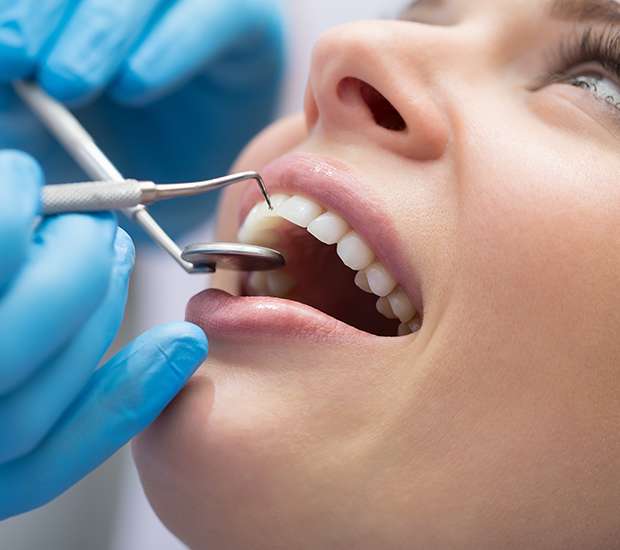 Long Grove Dental Bonding