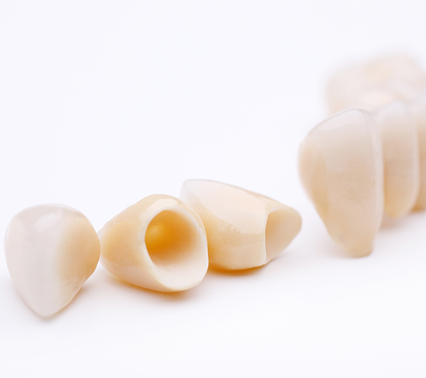 Long Grove Dental Crowns and Dental Bridges