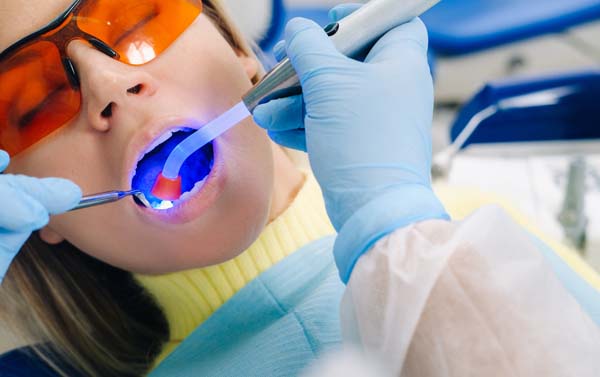 Reasons To Choose A Composite Filling Over A Silver Filling