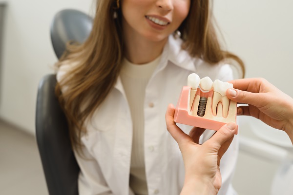 Why Dental Implants Are Comfortable And Secure