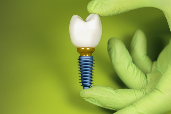 Why You Should Not Fear The Surgery To Get Tooth Implants