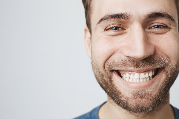 The Advantages Of Dental Veneers