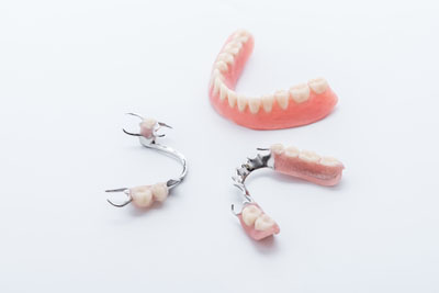 An Implant Dentist Compares Dentures, Dental Bridges, And Implants
