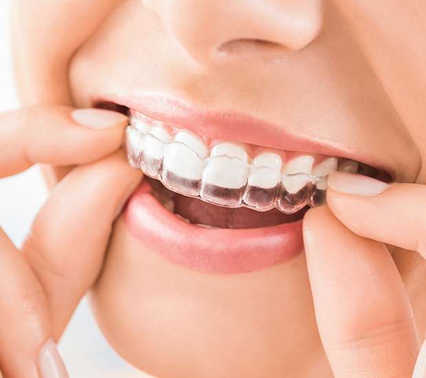 Long Grove Does Invisalign® Really Work?