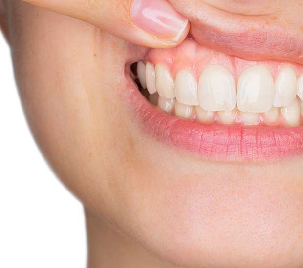Long Grove Gum Disease