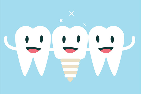Implant Dentistry Aftercare FAQs