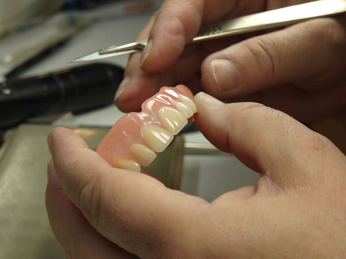 Replace Missing Teeth With Implant Supported Dentures