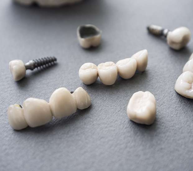 Long Grove The Difference Between Dental Implants and Mini Dental Implants