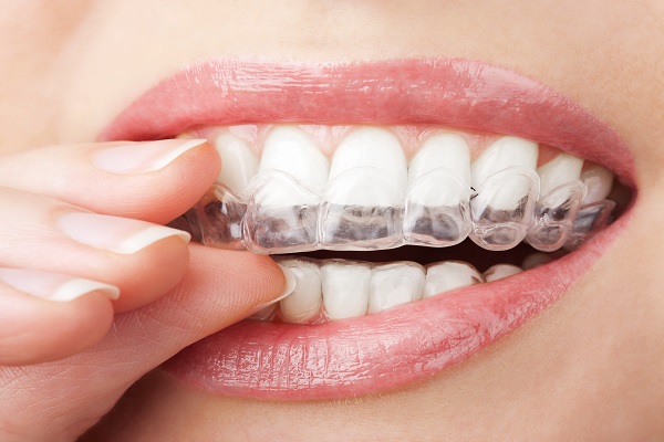 Invisalign &#    ; How Teeth Straightening Positively Impacts Your Oral Health