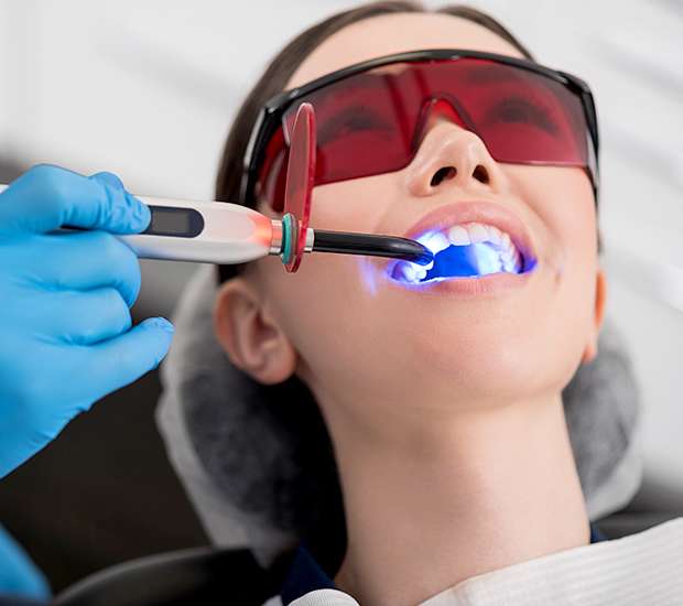 Long Grove Professional Teeth Whitening